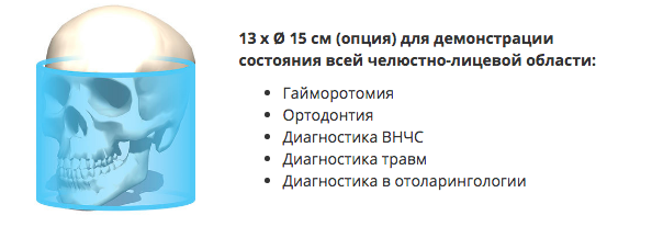 13x15.png 13x15.png