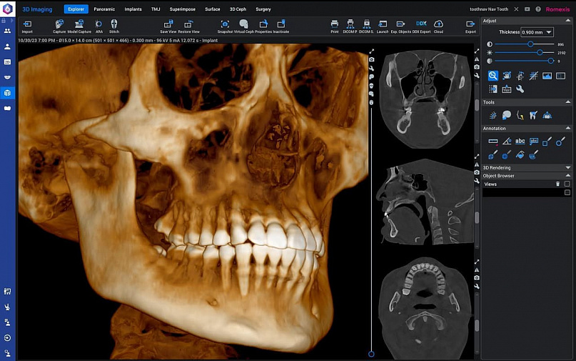 Дентальный 3D томограф Planmeca ProMax 3D Mid  (20x17 см) #3